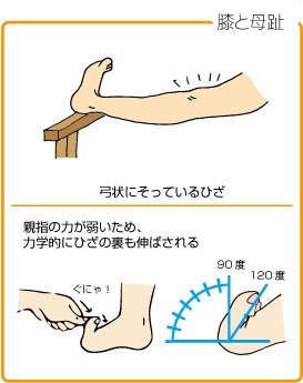 ダンサーのヒザ裏痛　反張膝気味の女性